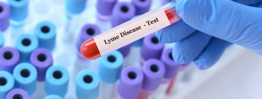 lyme diagnose stellen
