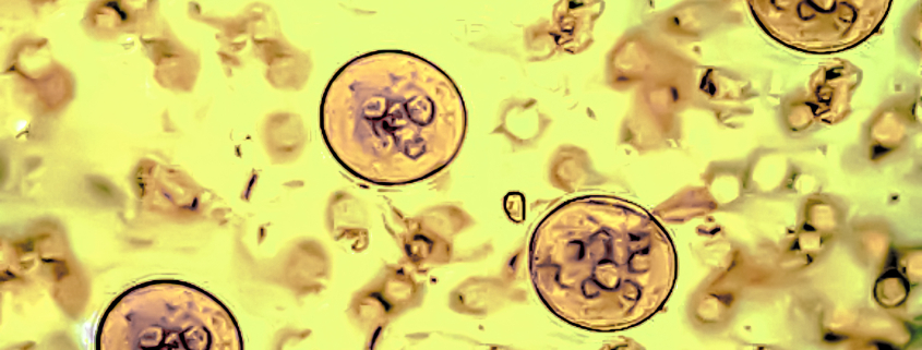 parasitaire infecties symptomen