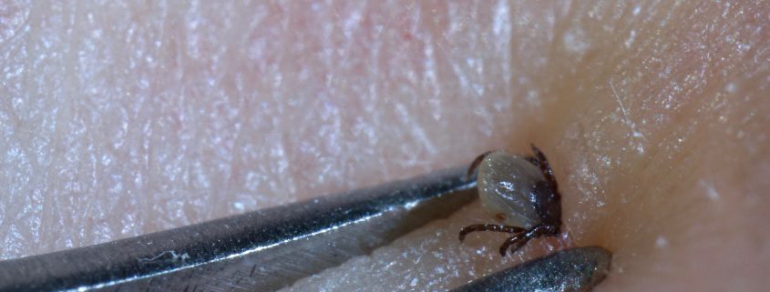 ziekte van lyme zonder rode kring